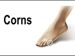 how to get rid of corns on foot