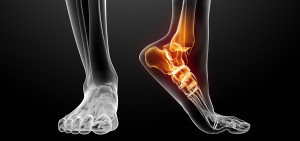 Pain at the back of your ankle, above your heel, is related to the achilles tendon