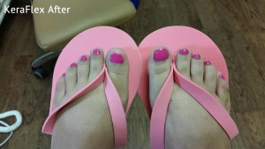 Safe pedicures and fungal nail treatments give nails you can show off anywhere