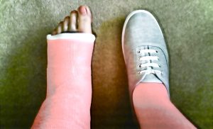 see a podiatrist for quick and effective broken foot treatment